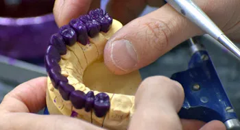 歯科技工の精密作業風景